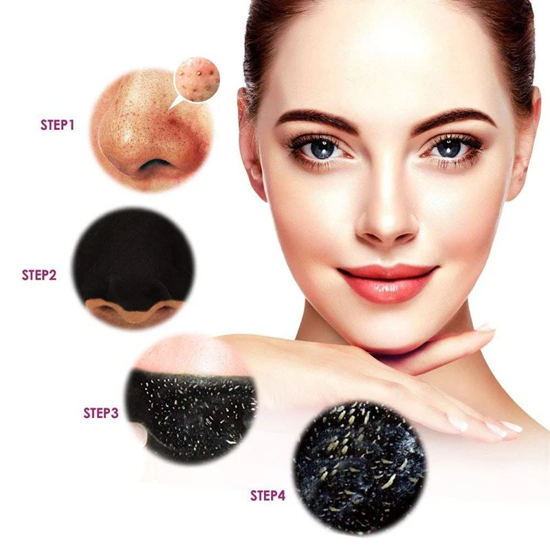 Shifei Aktivkohle Nasenstrips – Tiefenreinigend (6er Pack)