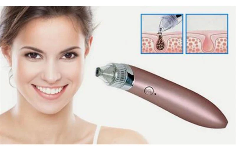 UNIQ Blackhead Suction - Mitesserabsaugung