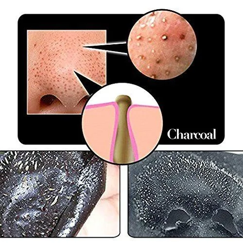 Shills Schwarze Peel-off Maske – Gegen Mitesser & Unreinheiten