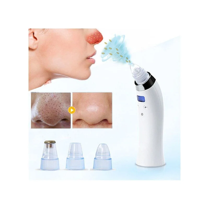 Blackhead Suction Pro+ | Saugt 99 % aller Mitesser aus