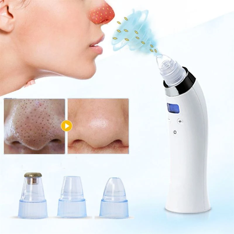 UNIQ Blackhead Suction Pro – Effektiver wiederaufladbarer Mitesserentferner zur Porenreinigung