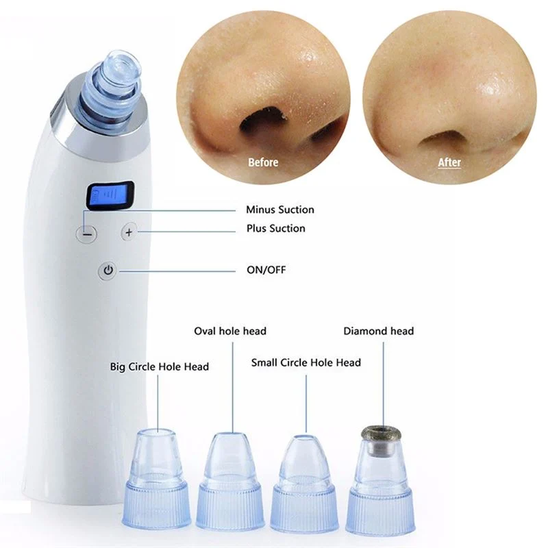 UNIQ Blackhead Suction Pro – Effektiver wiederaufladbarer Mitesserentferner zur Porenreinigung