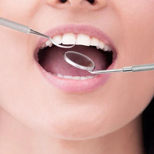 Zahnreinigungsset 4 teilig für Dental Hygiene - 1 Mundspiegel, 2x Kürette Zahnreiniger, 1 Schaber